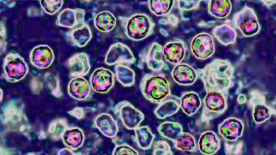 Measles Outbreak Spreads From SC to Washington State