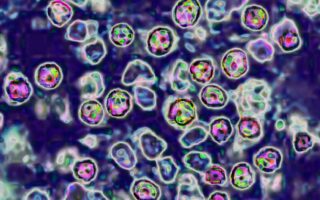 Measles Outbreak Spreads From SC to Washington State