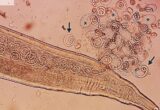 Man Has 11 Living Worms Pulled From His Eyes in South Korea