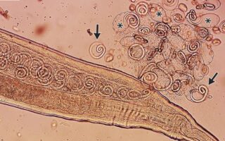 Man Has 11 Living Worms Pulled From His Eyes in South Korea